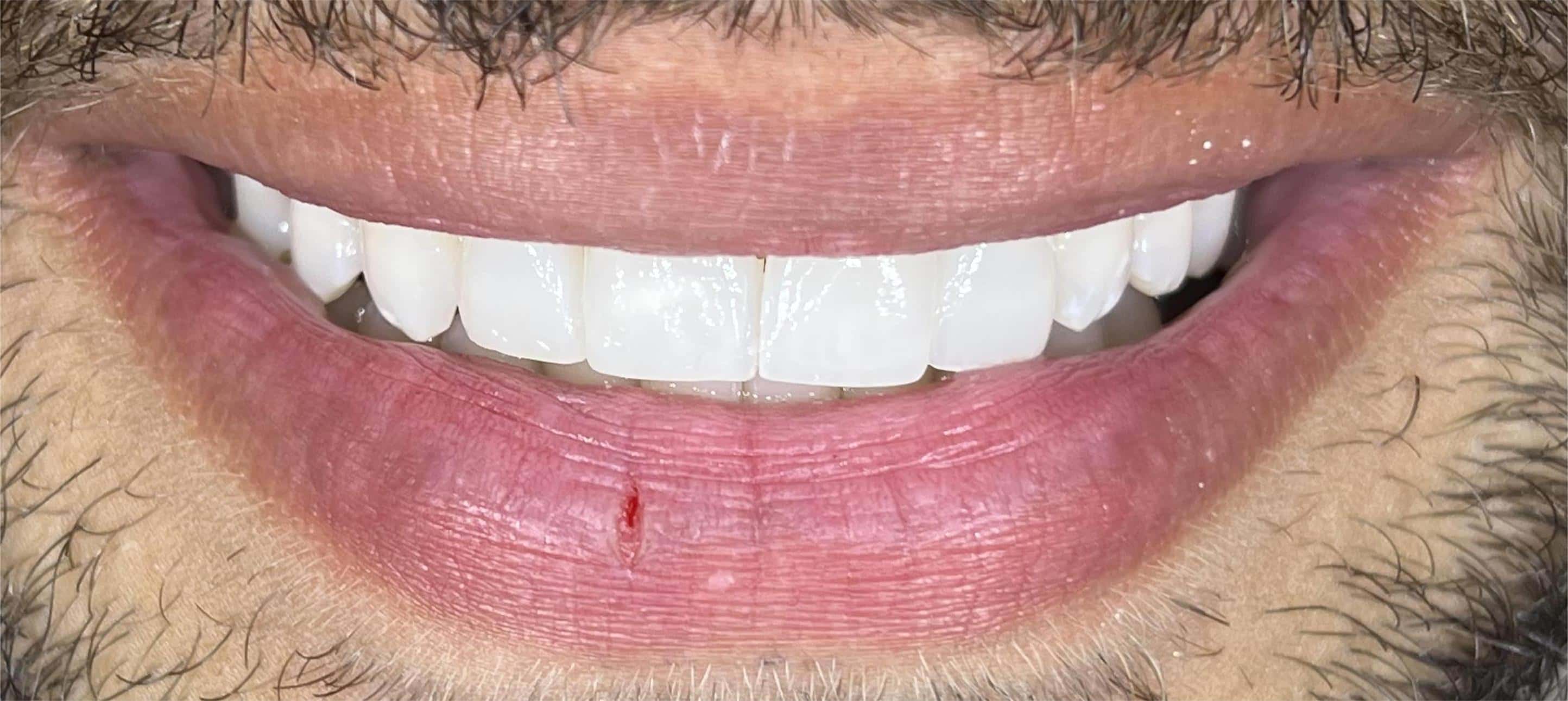 Dental transformation after treatment at Beyond Smiles Dental Clinic