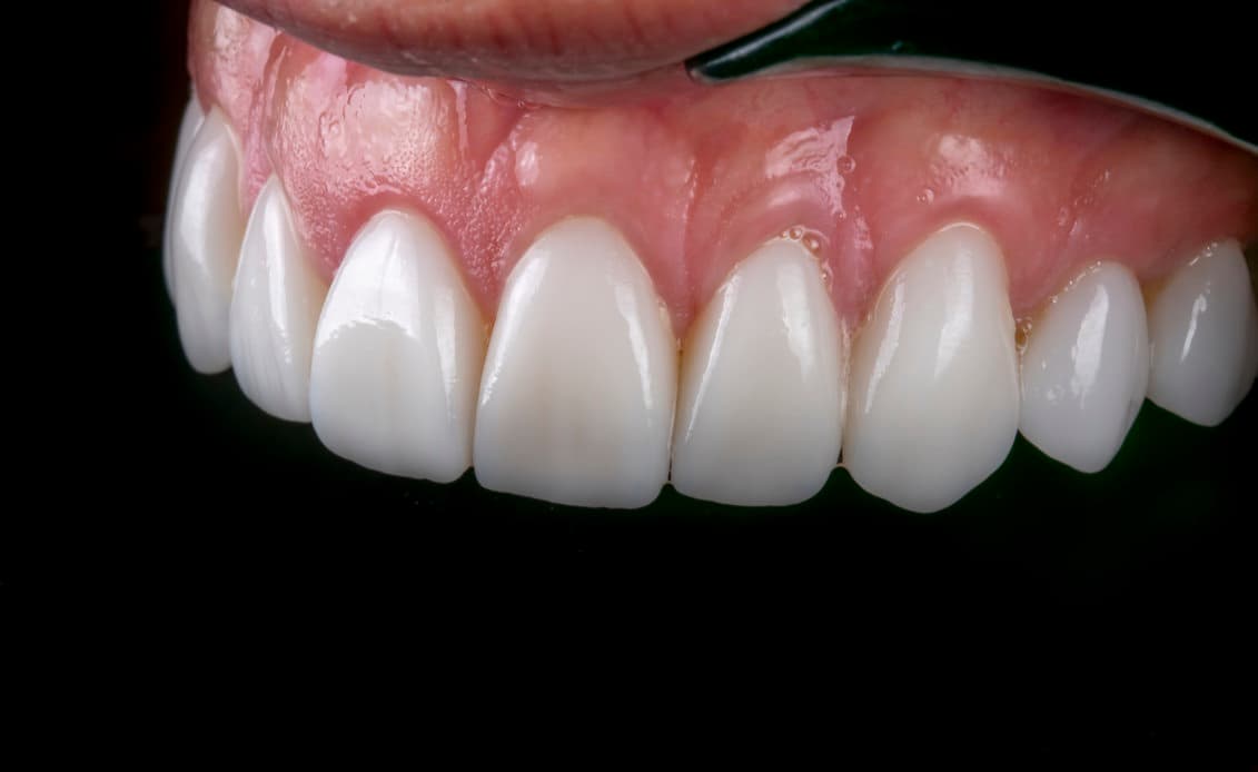 Professional dental care at Beyond Smiles